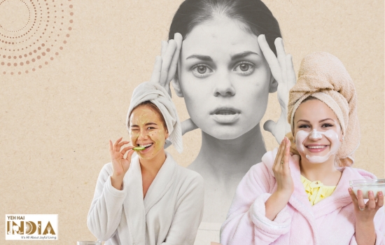 Top 10 Home Remedies for Acne