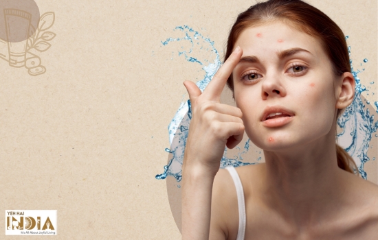 Best Safe Face Washes for Acne-Prone Skin